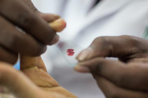 Close up of a sample slide with a drop of blood on it. Photo Credit: Mubeen Siddiqui/MCSP
